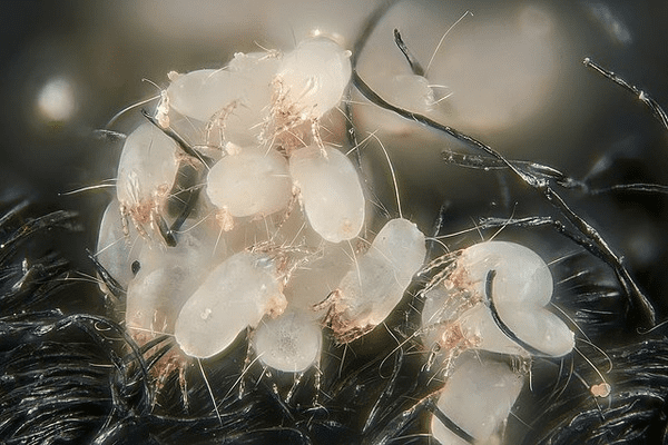 What's living in your mattress: the truth about dust mites